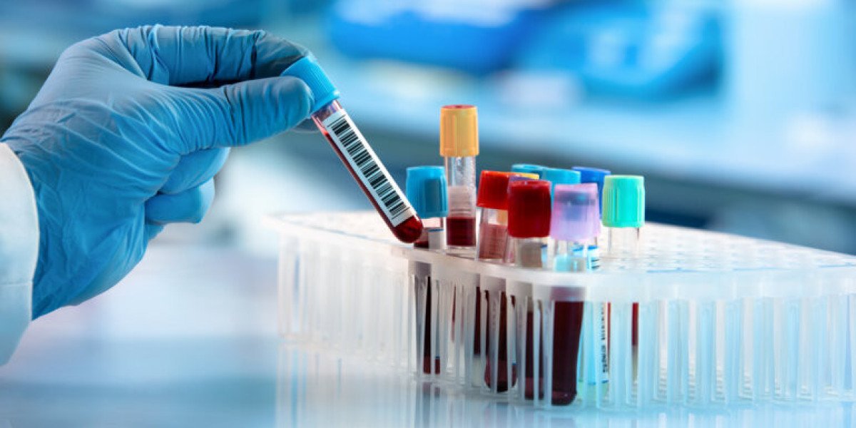 DNA Bowel Cancer Screening Kits Market Size, Dynamics & Forecast Report to 2032