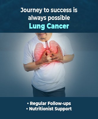 Best Lung Cancer Treatment Hospitals in Bangalore